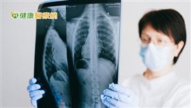 過往晚期肺癌患者手術後只有化療一途，現在先以基因檢測，了解是否有特定基因突變，為每一位肺癌病友制定適用的治療策略。(圖片出處: Pexels.com)