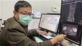 長安醫院今（22）日分享特殊病例，一名47歲邱先生腰部和腳部長期疼痛，後來發覺雙腳越來越無力，幾乎沒辦法走路，赴該院神經外科看診，醫師李漢忠追問得知，邱先生連大小便都有問題，除了頻尿還會失禁，核磁共振發現脊椎竟有2顆腫瘤。(長安醫院)