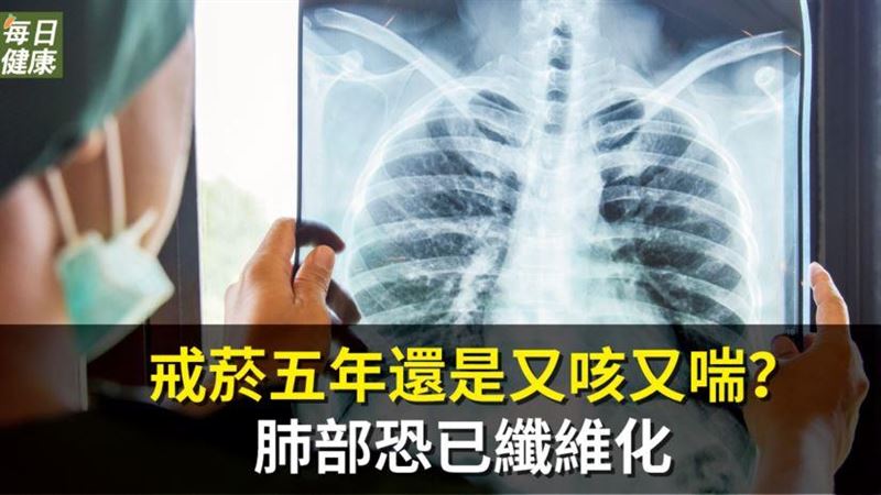 戒菸五年還咳又喘？　肺部恐已纖維化