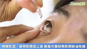 名家專用／NOW健康／現代人長時間使用3C用品，導致乾眼症成大眾的文明病。(勿用)