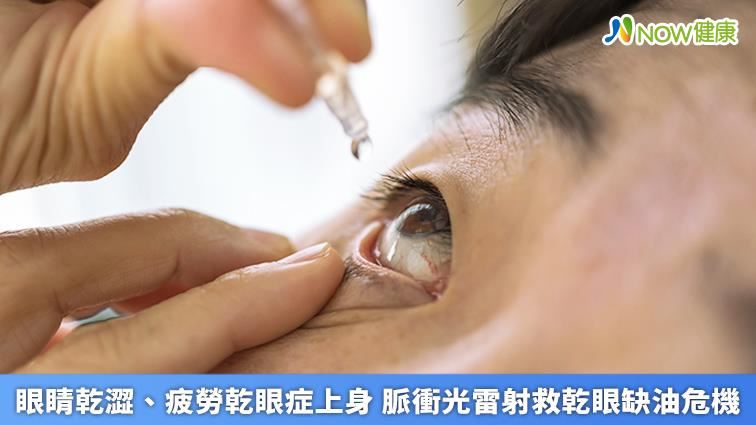 眼睛乾澀　脈衝光雷射救乾眼缺油危機