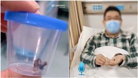 男誤吞鴨脖骨卡左肺。（圖／翻攝自微博＠湖北日報）