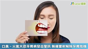 名家專用／NOW健康／徐慶雲醫師提醒，一旦發現牙齦紅腫、刷牙流血、加上有口臭等牙周病警訊，應尋求牙醫師診治，及早治療，才有助牙周病及早獲得控制。(勿用)
