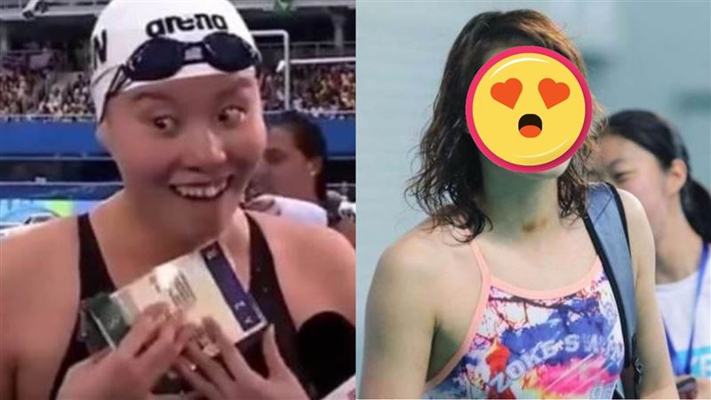 洪荒少女矯正牙齒後　竟美成劉詩詩！