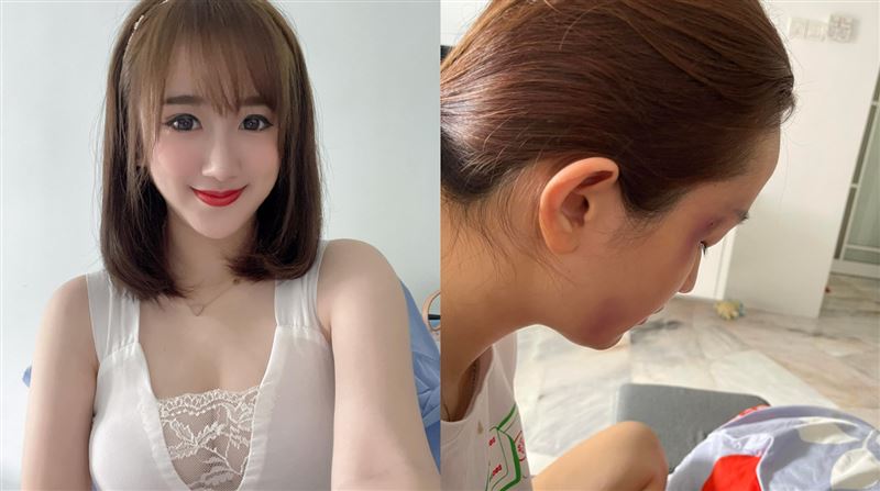 正妹女神遭痛毆送醫　賭博欠債下場慘