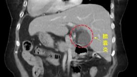 鏡面人,急診,中國醫藥大學新竹附屬醫院,谷君平醫師（圖／中醫大新竹附醫提供）