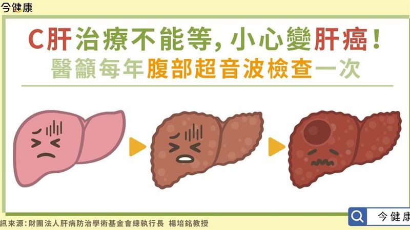 C肝治療不能等　醫籲每年檢查一次