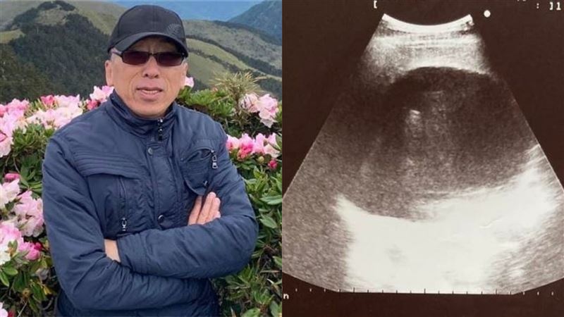 苦苓突爆「生前告別式」：死而無憾了