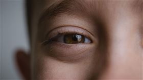  男童，新冠肺炎確診，眼睛腫脹快爆出來 (圖／PIXABAY)