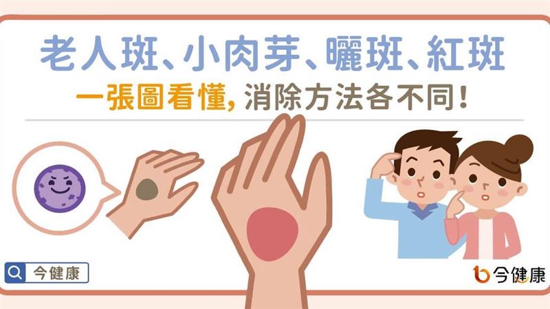 一張圖看懂　這些消除方法各有不同！