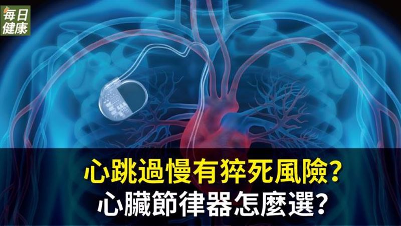 心跳過慢有猝死風險　心臟節律器怎選