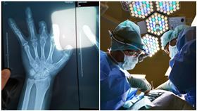  自費43萬高級醫材！他手術5年後才知：根本沒放進我體內（圖／翻攝自新京報）