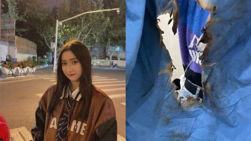 女星跳到一半衣服起火　公司冷血處理