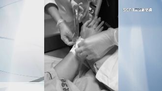 音樂家左手遭砍　復健恐難找回手感