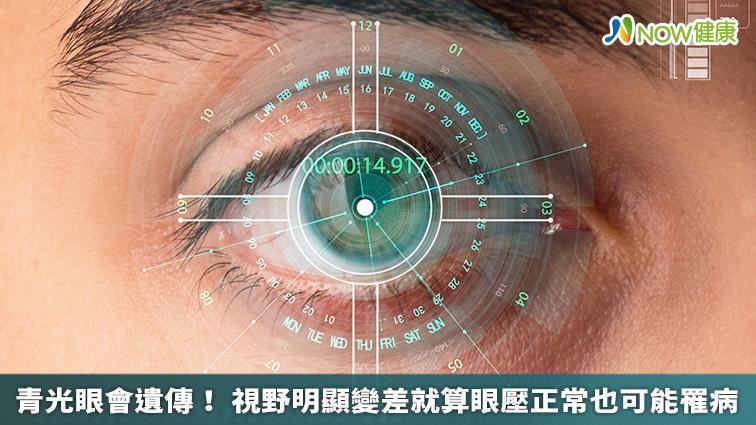 青光眼會遺傳！眼壓正常也可能罹病