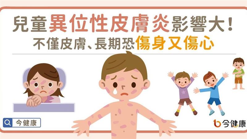 兒童異位性皮膚炎影響甚大！