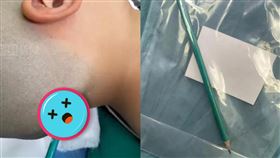 中國有名8歲男童，與父親爭執時，鉛筆意外插進後腦勺。（圖／翻攝自《人民網》）