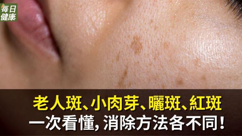 年紀增長皮膚生出斑塊　該如何防範？