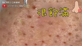 ▼▲美容師拔出各種形狀的皮脂管絲和粉刺。（圖／피지대마왕tv 授權）
