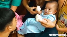 男嬰睿睿手術／羅慧夫顱顏基金會授權提供