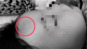 台南,飯店,關子嶺,嬰兒床,女嬰,瘀青