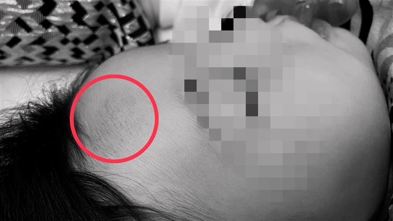 飯店嬰兒床板突掉落　女嬰慘摔頭瘀青