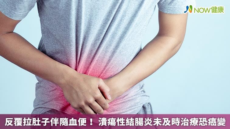 潰瘍性結腸炎　反覆拉肚子伴隨血便