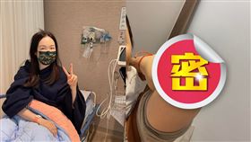 徐薇驚傳在家昏倒，事後在臉書報平安，並秀出倒地導致手肘大片瘀青、眼鏡斷裂的照片。（圖／翻攝自臉書）