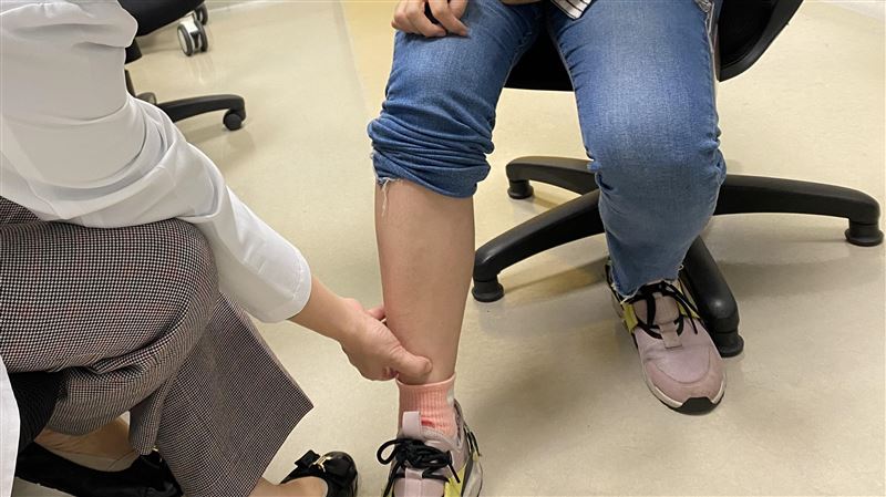 身體鬧水災　水腫恐是這些器官出問題