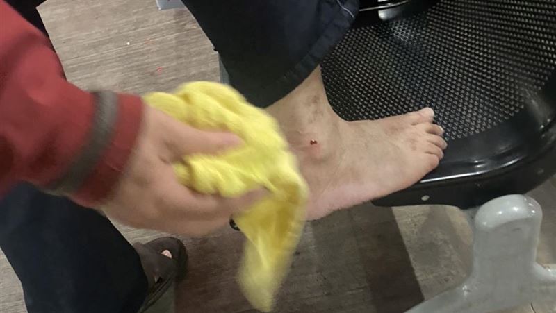 等火車腳踝冒血　老翁低頭驚見百足蟲