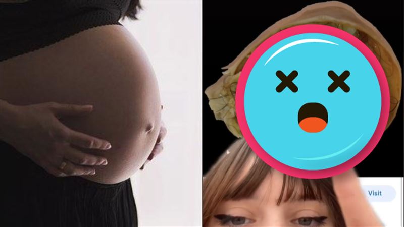 慎！婦產子腹痛2年　超音波照出怪胎