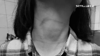 獨／婦騎車經公園　遭風箏線「勒脖」