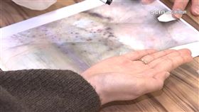 氣溫驟降！免疫紫斑症患者留意病情變化