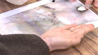 氣溫驟降！免疫紫斑症患者留意病情