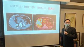 醫師指出，膽道癌早期難發現，如上腹痛持續，務必盡快安排超音波檢查。（圖／記者簡浩正攝影）