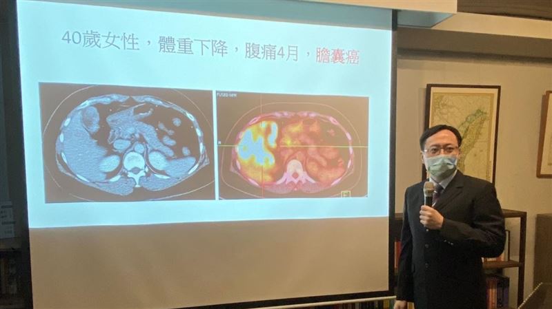 腹痛4月竟膽囊癌！「3症狀」快檢查