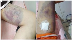 飼主,物流,送貨,和解,狗,咬傷（圖／翻攝自爆廢公社公開版）