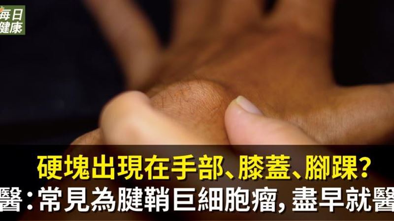 什麼是腱鞘巨細胞瘤？　醫籲盡早治療