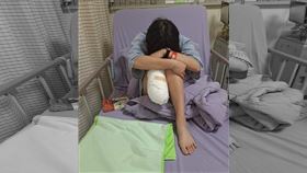 工傷，1100公斤貨物壓到，女子截肢照曝光，苗栗頭份　（圖／翻攝自PTT）