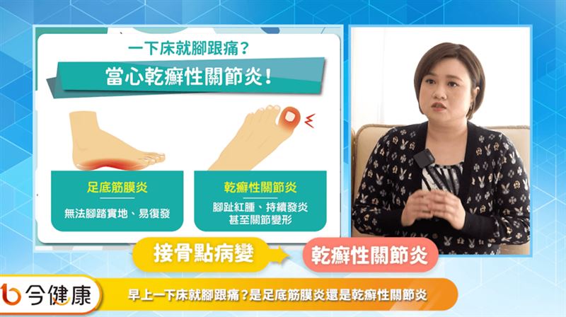 起床腳跟痛　如何區分乾癬性關節炎？