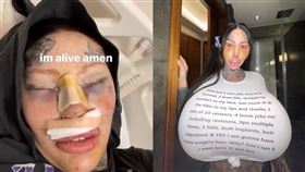 網美整型整上癮。（圖／翻攝自IG／@1800leavemaryalone）