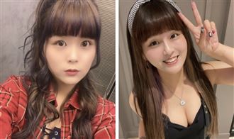 丟丟妹翻鍋濺油燙到手　嚴重傷勢曝光