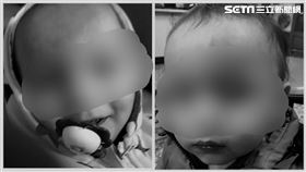 台中混血雙胞胎在托嬰中心受傷，家長追真相遭刁難。（圖／翻攝畫面）