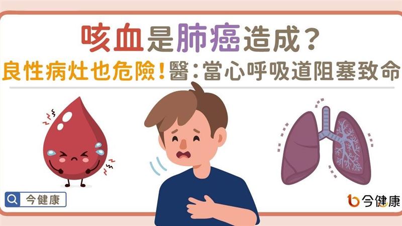 咳血是肺癌造成？　呼吸道阻塞會致命