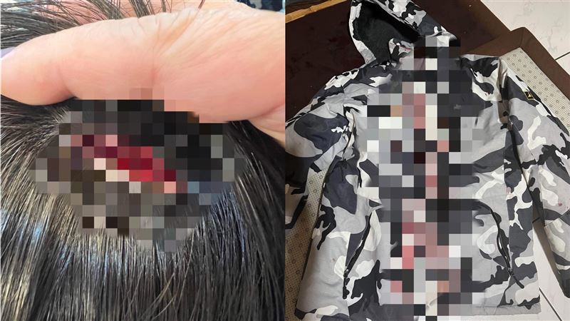 想拿回4百元欠款！同學烙3惡煞猛毆
