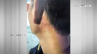 不滿被上銬　醉男趁機咬警脖子一口