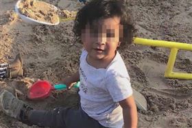 比特犬又傷人！1歲童遭撕咬五官全毀(圖/翻攝自FB)