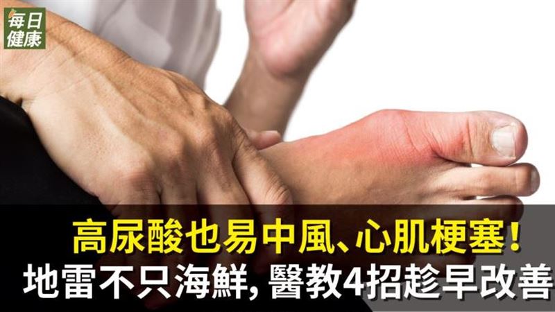 高尿酸不止影響痛風　醫教這四招改善