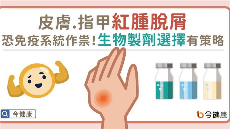 皮膚出現斑塊脫屑　當心乾癬找上身