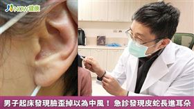 名家專用／亞大醫院神經內科主任王馨範說明，免疫力下降時，就容易引發帶狀疱診病毒感染。(勿用)